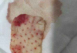 百度上的医生靠谱吗？听听“偷星星的猫”的分享吧！