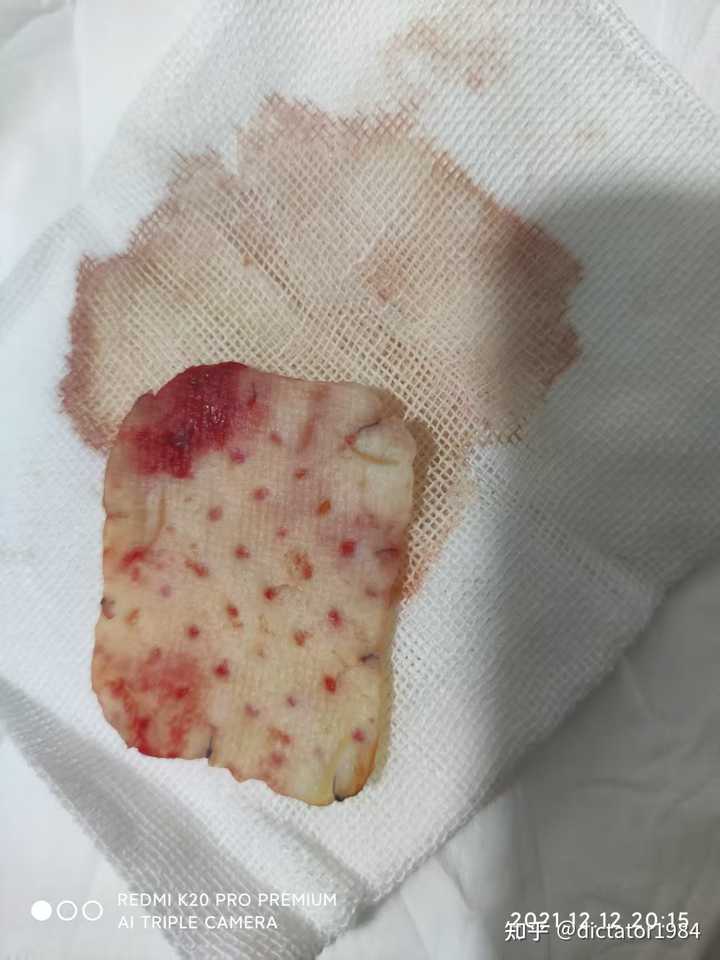 百度上的医生靠谱吗?听听“偷星星的猫”的分享吧!