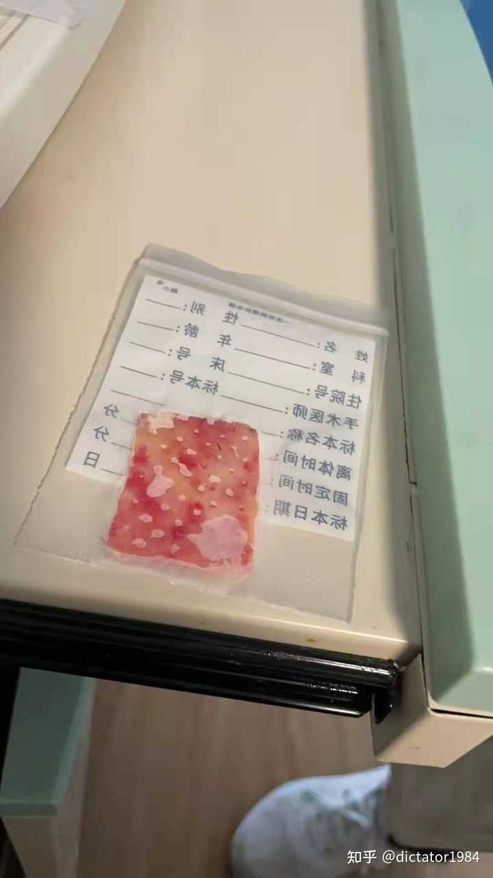 百度上的医生靠谱吗?听听“偷星星的猫”的分享吧!